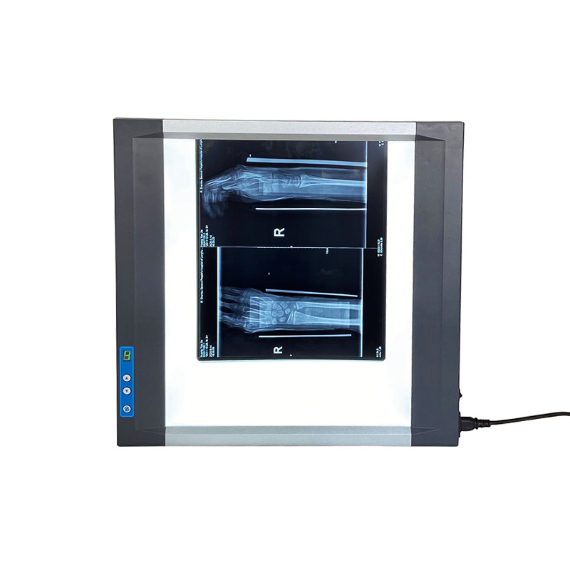Negatoscope LED double panneau pour radiographies
