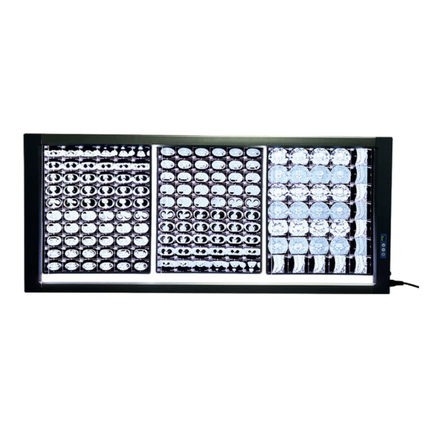 Negatoscope LED