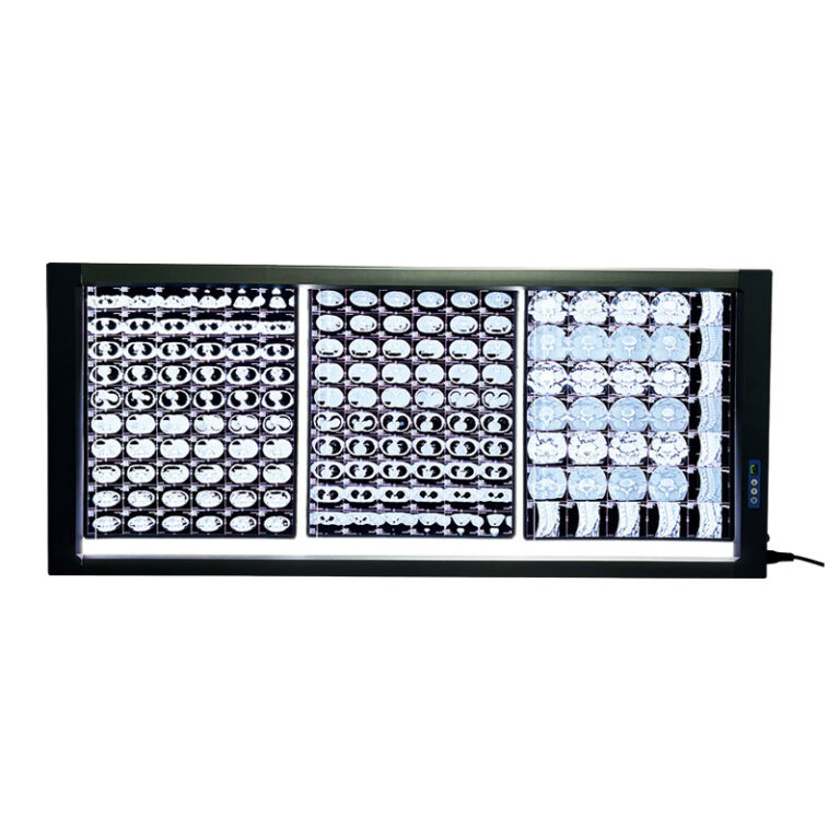 Negatoscope LED